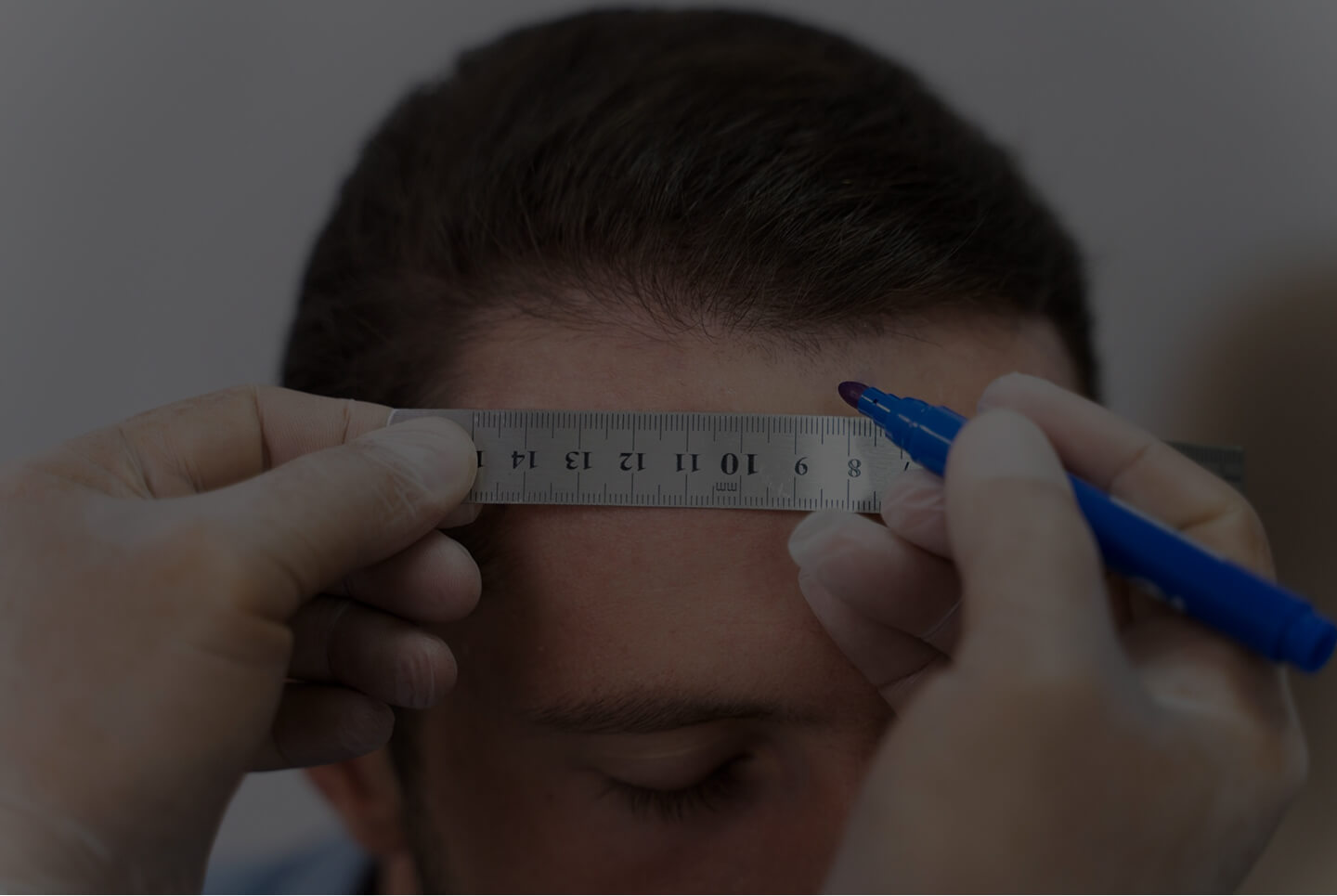 Procedimiento de implantes