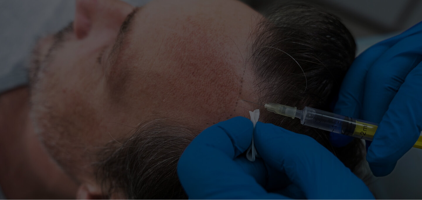 Procedimiento de implantes